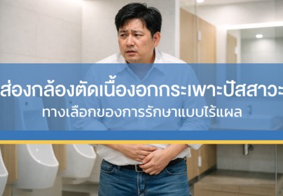 TURBT นวัตกรรมส่องกล้องตัดเนื้องอกกระเพาะปัสสาวะ  ทางเลือกของการรักษาแบบไร้แผล